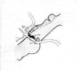 Location of flour Mill, corn mill, landing stage and weir